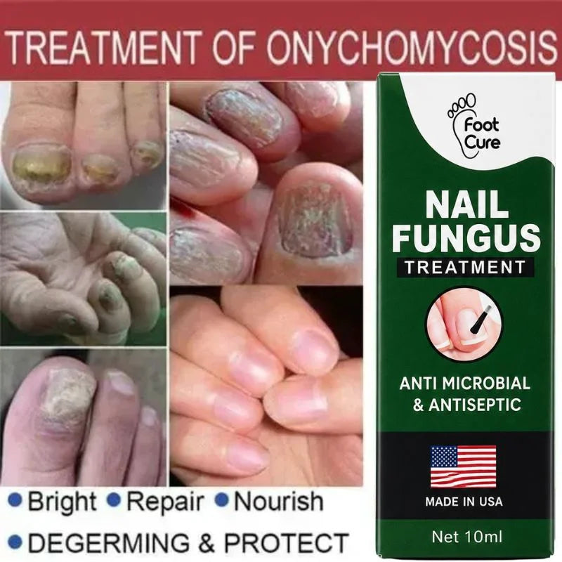 Fast Nail Fungus Treatment Serum YMDS