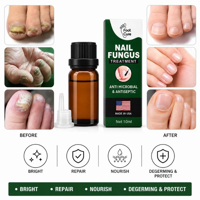 Fast Nail Fungus Treatment Serum YMDS