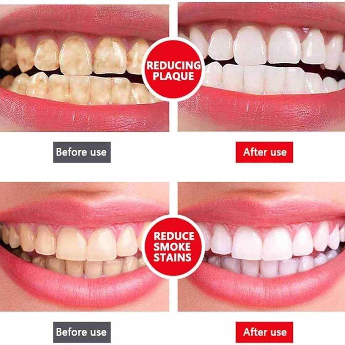 Yayashi SP-4 Ultra Whitening Toothpaste YMDS