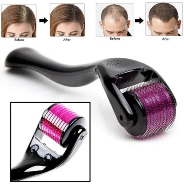 Derma Roller 0.5mm for Hair & Skin Therapy YMDS