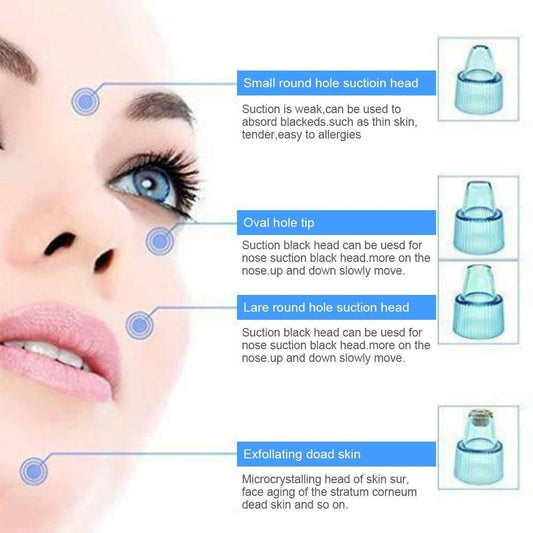 Cell Operated Blackhead Removal Machine ARDS