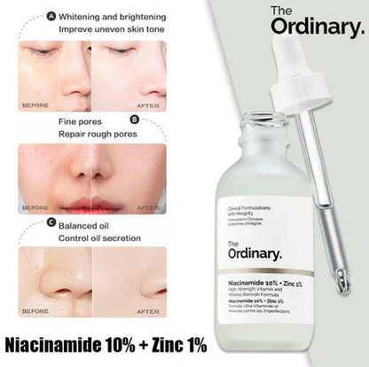 The Ordinary Niacinamide Serum 10% + Zinc 1% – 30ML Supersize | Buy 1 Get 1 Free HHC