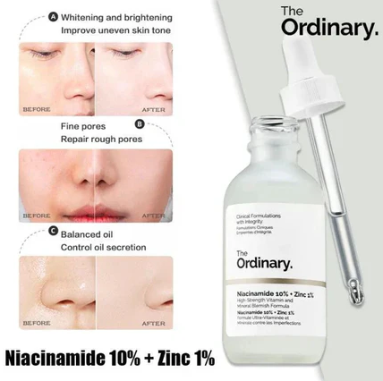 The Ordinary Niacinamide Serum 10% + Zinc 1% – 30ML Supersize | Buy 1 Get 1 Free HHC