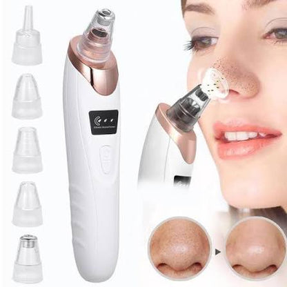 5-in-1 Blackhead Remover Machine – Rechargeable Face Vacuum with 5 Heads HHC