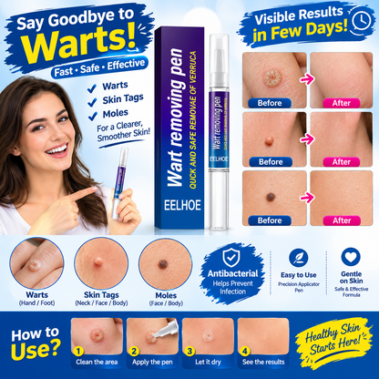 Wart Remover Gel Pen – Powerful Wart Removal HHC