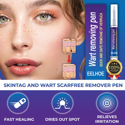 Wart Remover Gel Pen – Powerful Wart Removal HHC