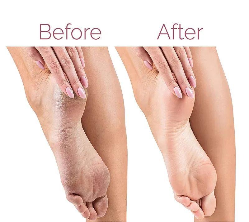 Electric Foot File for Heels Grinding Pedicure Tools