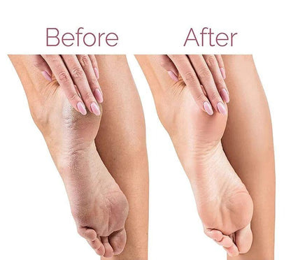 Electric Foot File for Heels Grinding Pedicure Tools