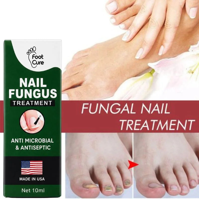 Fast Nail Fungus Treatment Serum YMDS