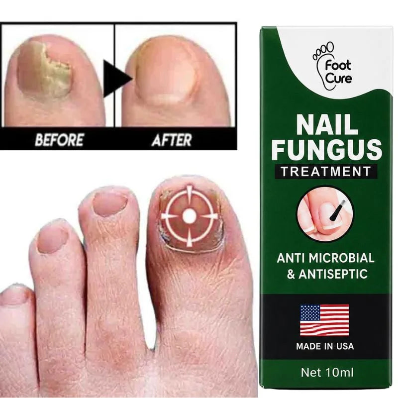 Fast Nail Fungus Treatment Serum YMDS