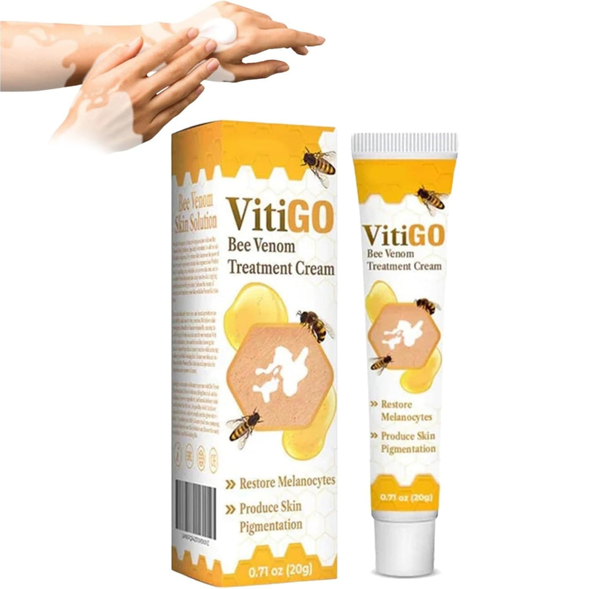 Vitigo Bee Venom Treatment Cream YMDS