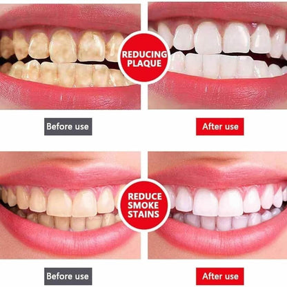 Yayashi SP-4 Ultra Whitening Toothpaste YMDS