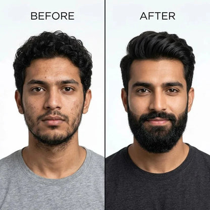 Dr. Alies Professional Beard Growth Oil YMDS