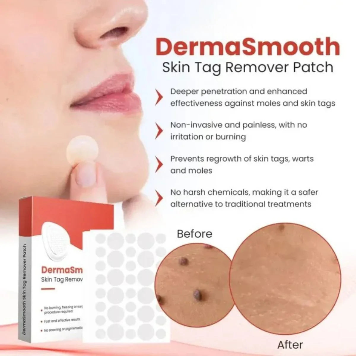 DermaSmooth Skin Tag Remover Patch Rida's Collection