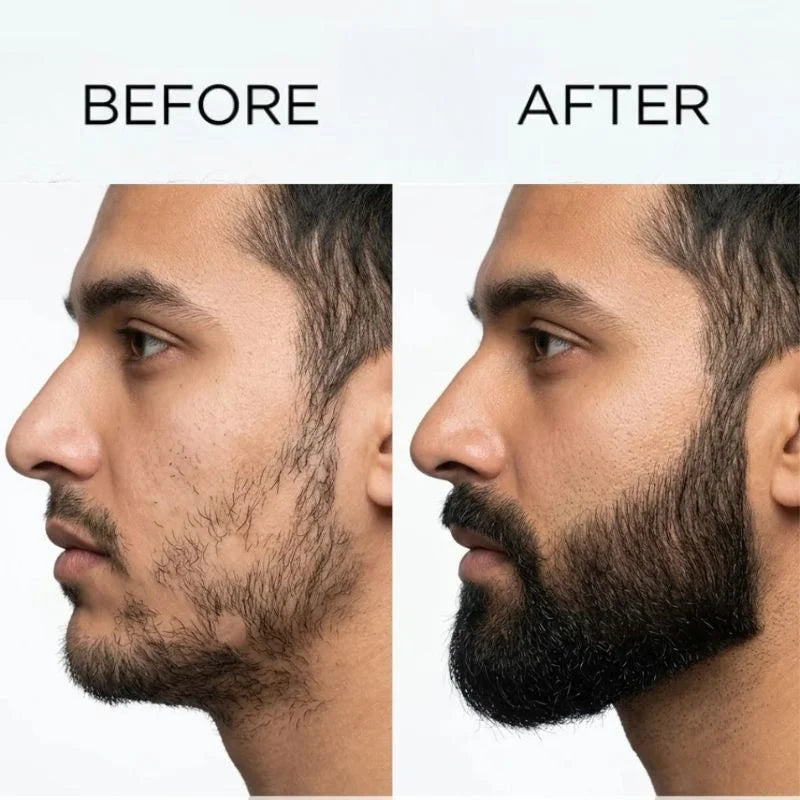 Dr. Alies Professional Beard Growth Oil YMDS