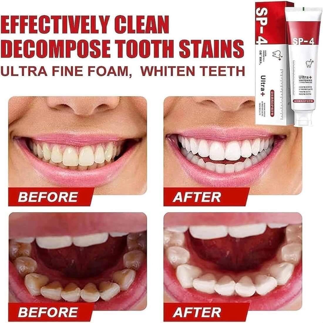 Yayashi SP-4 Ultra Whitening Toothpaste YMDS