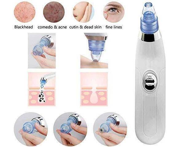 Blackhead Removal Machine | Derma Suction 3 In 1 Black Head Remover Machine YMDS