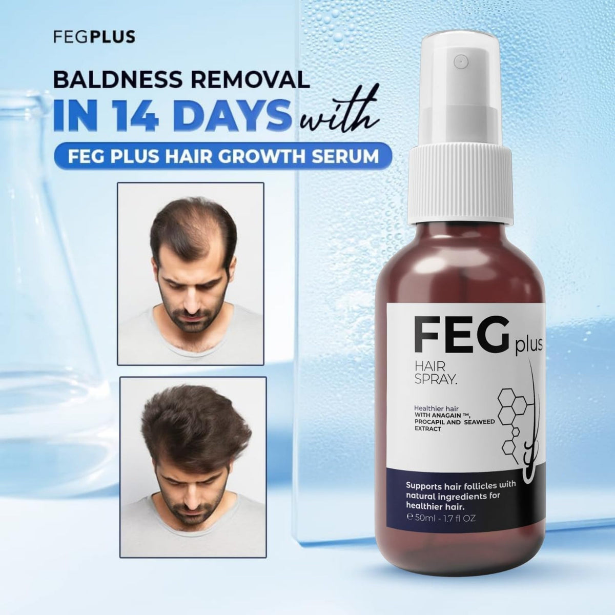 FEG Plus Hair Growth Spray 50ml YMDS
