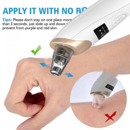 Blackhead Suction Remover Portable Pore Cleaner YMDS