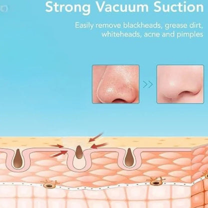 Rechargeable Blackhead Remover Vacuum Cleaner YMDS