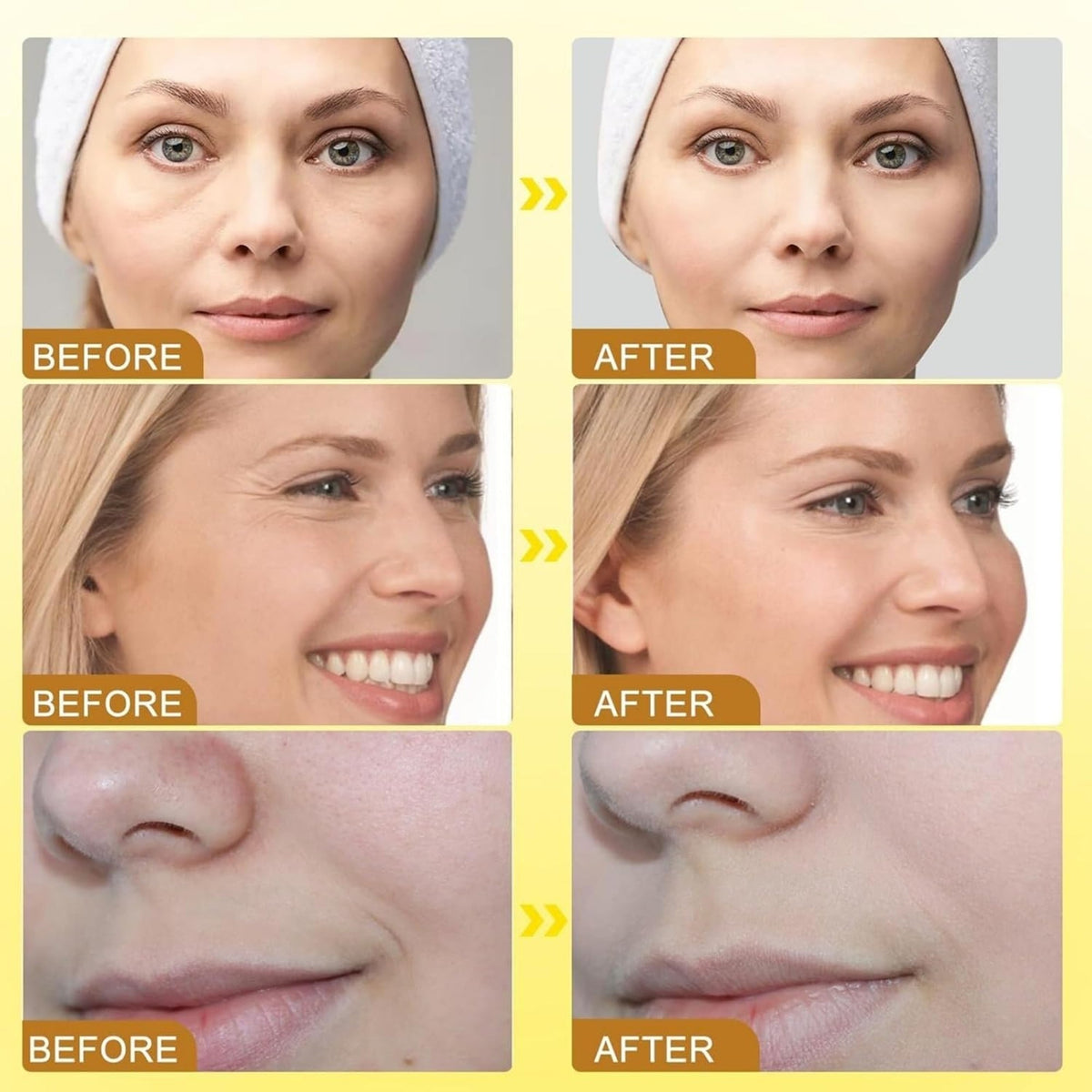 Botox Bee Venom Wrinkle Cream in Pakistan YMDS