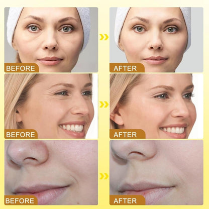 Botox Bee Venom Wrinkle Cream in Pakistan YMDS
