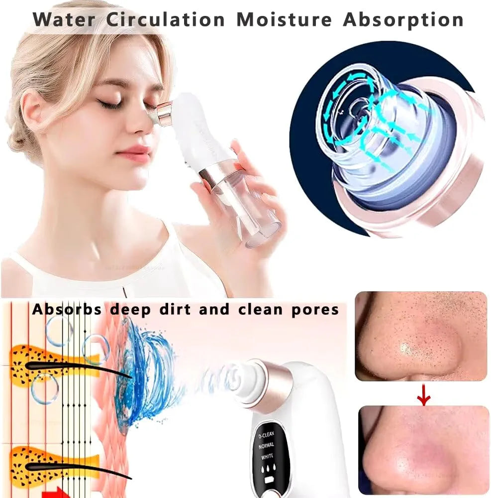 Water Cycle Blackhead Pore Cleanser 3 Adjustable Suction 6 Modes ARDS