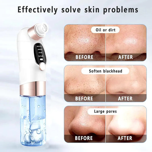 Water Cycle Blackhead Pore Cleanser 3 Adjustable Suction 6 Modes ARDS