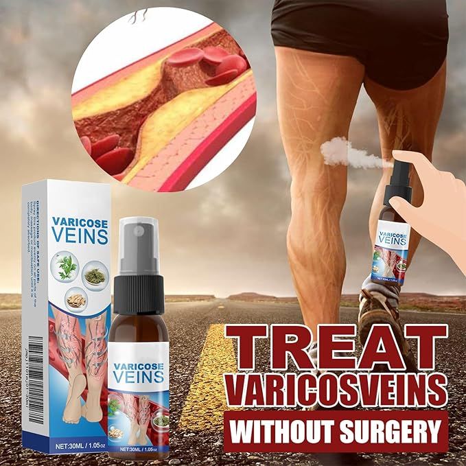 Varicose Vein Spray Herbal Body Care for Vasculitis And Phlebitis Relief ARDS