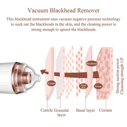 Slim Blackhead Rechargeable Suction Device Kit Pore Cleaner Rida's Collection