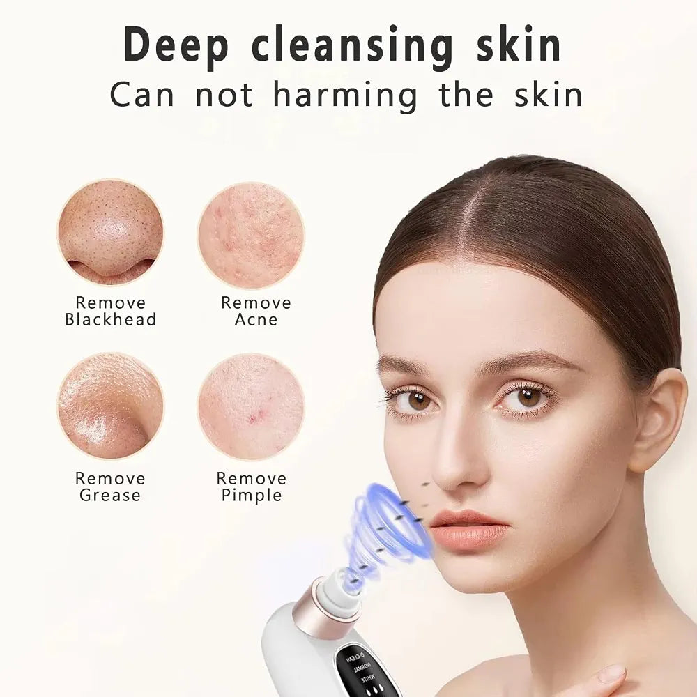 Water Cycle Blackhead Pore Cleanser 3 Adjustable Suction 6 Modes ARDS