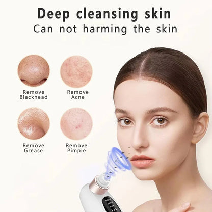 Water Cycle Blackhead Pore Cleanser 3 Adjustable Suction 6 Modes ARDS
