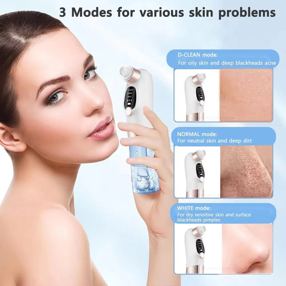 Water Cycle Blackhead Pore Cleanser 3 Adjustable Suction 6 Modes ARDS