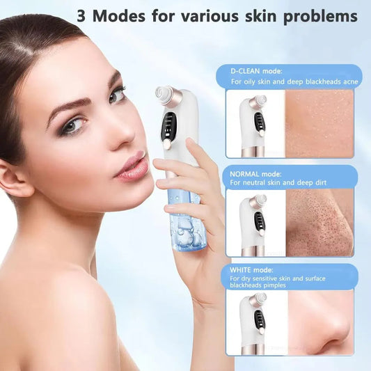 Water Cycle Blackhead Pore Cleanser 3 Adjustable Suction 6 Modes ARDS