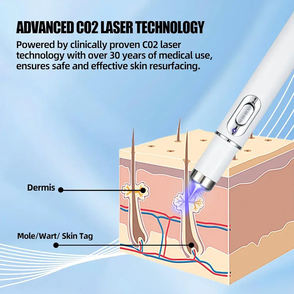 Mole And Wart Removal Pen Non Invasive Mole And Wart Removal ARDS