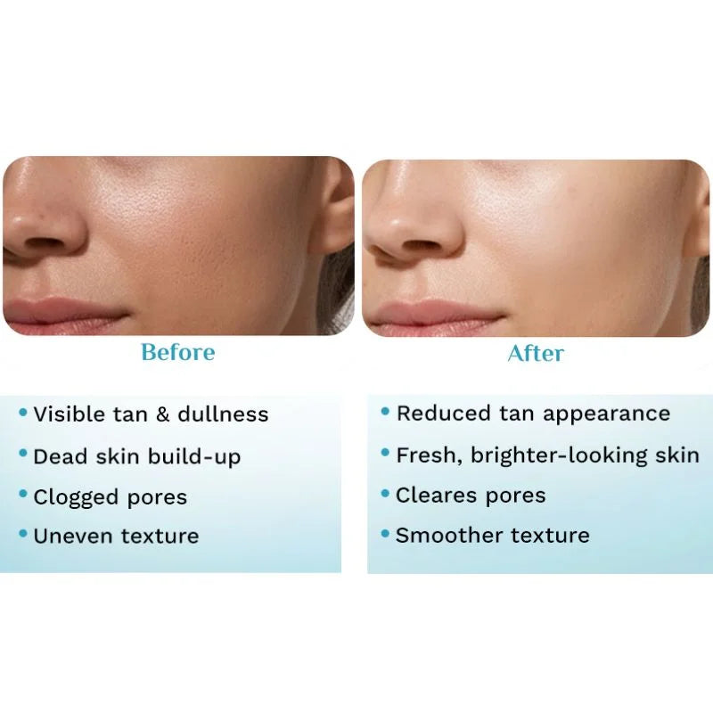 Pilgrim Peeling Solution