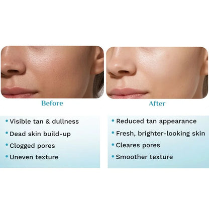 Pilgrim Peeling Solution