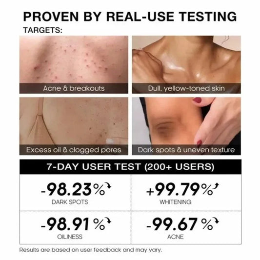 TeaShell Niacinamide Skin Brightening Soap YMDS