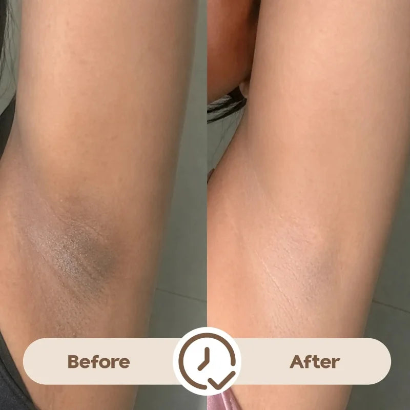 Ray Time To Shine Underarm Serum